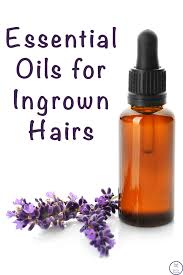 Ingrown hairs are a common, benign skin disorder seen in all age groups. Essential Oils For Ingrown Hairs With Recipes Simple Living Creative Learning