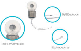 We did not find results for: How Does Cochlear Implant Work My Baby S Hearing