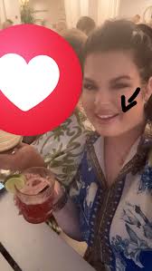 Had falling off the wagon after 2 months of sickness and had to do revision  aligners…if you have invisalign do They have rough edges and what do you do  to get rid