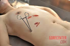 Autopsy pictures Asian woman