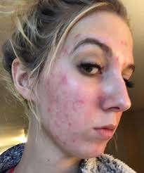 Hey Girlies! As I'm trying to become more active