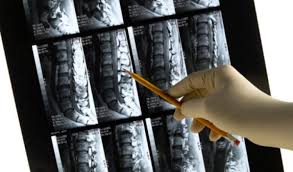 Image result for vyhřezlá ploténka