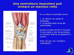 Lesione Al Menisco Mediale O Laterale Il Segreto Sulle Cause E I Tipi