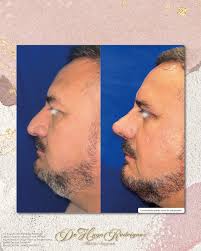 Dr. Hugo Rodriguez Cirugía plástica, estética y Reconstructiva added a new  photo — in Ciudad Juárez,...