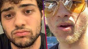 Mix turmeric powder and lemon juice into a thick paste. Noah Centineo Baffles Everyone By Bleaching His Facial Hair Access