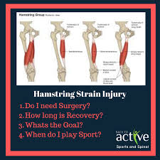 Treatment strategies for hamstring strains: Hamstring Strain Injuries Back To Active Sports And Spinal Macquarie Park