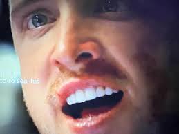 Why Did Freddie Mercury Never Fixed His Teeth? #freddiemercury  #BOOMchallenge