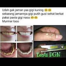 Pasta Gigi Nasa Mau Tau Manfaat Pasta Nasa Rembang Diyah Nasa Facebook