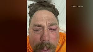 Spokane Valley driver loses vision after getting hit with a paintball