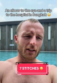 A cut in Asia = a trip to the emergency room for SEVEN STITCHES 😳😳  #Hospital #Elbow #SydneyFC