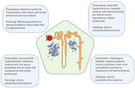 Chronic kidney disease, also called chronic kidney failure treatment for chronic kidney disease focuses on slowing the progression of the kidney damage, usually by controlling the underlying cause. Frontiers Biomarkers And Diagnostic Testing For Renal Disease In Sjogren S Syndrome Immunology