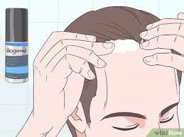It will greater than probably work well and provides wonderful. 3 Ways To Make Your Hairline Grow Back Wikihow