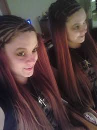 Luxury braided wigs for hair loss?