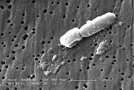 The aim of this study was to characterize. Klebsiella Wikipedia