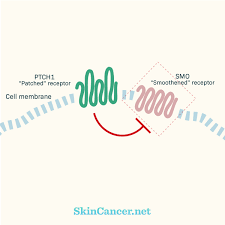 According to the american cancer society, just over 100,000 new cases of skin cancer are diagnosed in the united states each year. Skin Cancer Causes Genetic Mutations Skincancer Net