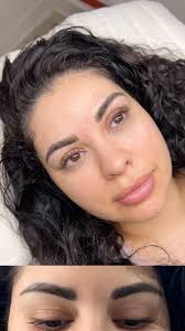 Wifey’s removal ❤️, Carolina was getting microblading touchups once a year  for 5 years. It came to a point where there was an accumulation of ink and  it looked saturated. The best option in this case, ...