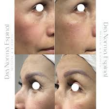 Dra. Norma Espinal. Md.Cirujano/ Md.Estetica