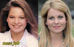 However, her amazing body transformation to a slim beauty has raised eyebrows. Plastic Surgery Hits