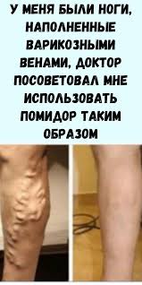 как избавиться от нежелательных волос на ногах в домашних условиях U Menya Byli Nogi Napolnennye Varikoznymi Venami Doktor Posovetoval Mne Ispolzovat Pomidor Takim V 2020 G Zhurnal O Zdorove Zdorove Fitoterapiya