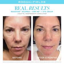 Rodan + Fields