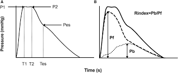 Hemodynamic Characterization of Primary Hypertension in Children and  Adolescents