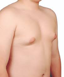 Redness or flaky skin in the breast. Buddies For Life Magazine Uplifting Format To Breast Cancer Survivors