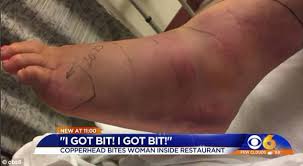 Résultat de recherche d'images pour "copperhead bites"