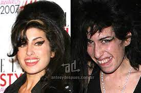 In my bed — amy winehouse. Amy Winehouse Y Sus Nuevos Dientes Antes Y Despues Promis Ungeschminkt Stars Ungeschminkt