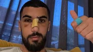 Aymen Barkok meldet sich erstmals nach Prügel-Attacke