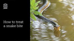 Image result for Snake Bite