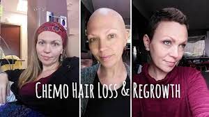 Unfortunately, there's very little actual research on whether rogaine can help cancer patients regrow some women regrow only the hair on their scalp, but never regrow their eyebrows or eyelashes. Chemo Hair Loss And Regrowth Timeline Youtube