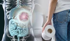 , produced by cancer council victoria. Bowel Cancer Symptoms Dark Red Or Black Poo Could Be A Sign Of The Deadly Disease Express Co Uk