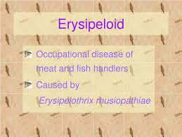 Image result for Erysipeloid