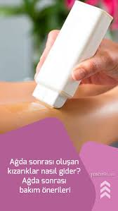 Agda Sonrasi Olusan Kizariklar Nasil Gider Agda Sonrasi Bakim Onerileri Bakken Gozler Yaz