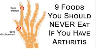 9 Foods You Should Never Eat If You Have Arthritis Arthritis Diet Arthritis Arthritis Treatment