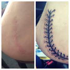50 times wanted tattoos to cover up their scars and. Pin On Baseball