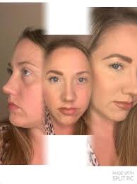 Albino girl discovers her beauty with makeup