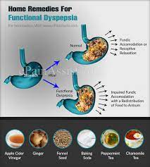 Home Remedies For Functional Dyspepsia & Can You Die From It?