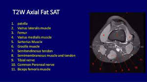 This section of the website will explain large and minute details of . Mri Anatomy Of Knee Dr Muhammad Bin Zulfiqar