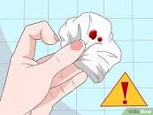 Resultado de imagen para "sangrado rectal"