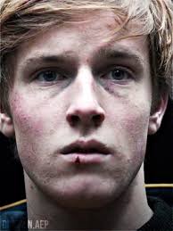 Are Werner and Frederick Gay in All The Light We Cannot See