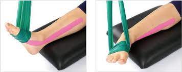 Klinik, pathomechanik und behandlungsoptionen | zusammenfassung die. Knick Senkfuss Schwache Der Tibialis Posterior Sehne Gelenk Klinik De