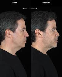 Daniel Roscher Ortognática Maxilofacial