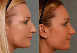 For jobs in some industries, it can be a good idea to try during their main hiring season. 10 Best Clinics For Nose Surgery In South Korea 2021 Prices