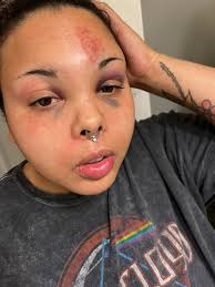 Gonna post pics from both my motorcycle accidents in the comments. Dont  have video of the actual wreck but what I was doing right before. Being an  idiot