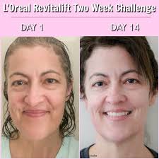 L Oreal Paris Revitalift Triple Power Does It Work Loreal Paris Loreal Revitalift Loreal