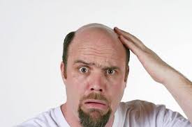 Jom ketahui apa punca rambut gugur dan kelemumur. 9 Faktor Mengapa Rambut Lelaki Mudah Gorilla Beard Oil Facebook