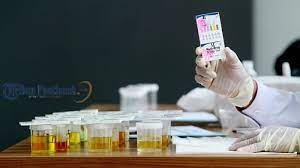 We did not find results for: Warna Urine Ternyata Indikasikan Penyakit Tertentu Lho Cek Warna Urinemu Deh Tribun Pontianak