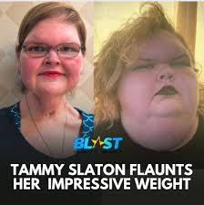 Post Caption⁠ #TammySlaton is receiving an outpouring of support from fans  as she continues her impressive #weightloss journey.⁠ ⁠ #TLC's "1000-Lb  Sisters" star recently debuted her slimmed-down figure in a swimsuit, posing