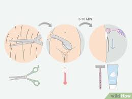 How To Get Rid Of Ingrown Pubic Hair With Pictures Wikihow
